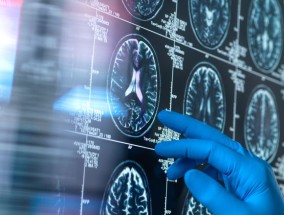 研究指出了11种老年痴呆症的“强预测因素”——如何降低风险