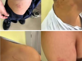 天津一10岁男孩疑遭老师殴打，官方回应：已成立处置专班