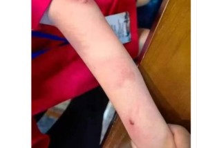 杭州9岁围棋少年疑遭父亲家暴跳楼身亡，相关部门：仍在调查中