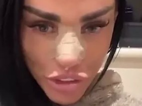 凯蒂·普莱斯（Katie Price）在展示自己最新的隆鼻手术时，承认自己“隐瞒”了自己的术后护理