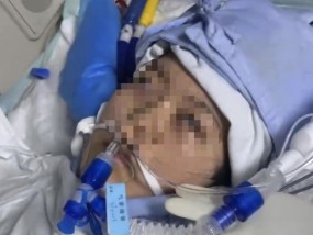 22岁美甲师手术成功却在复苏室脑死亡，家属称缺氧30分钟监护医生未察觉，医院回应